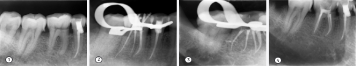 operating_case