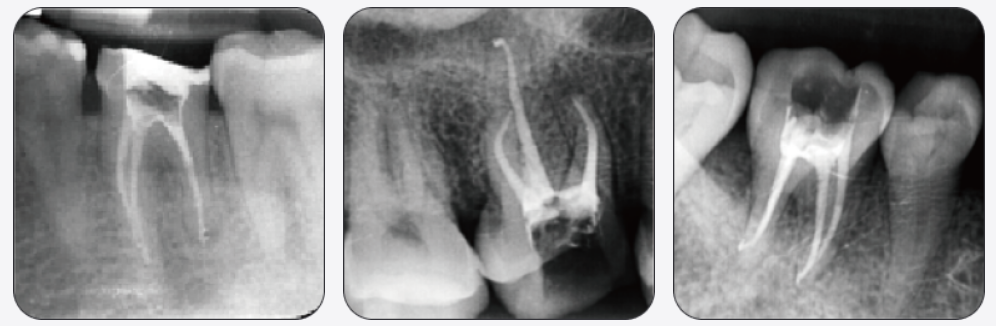 operating-cases